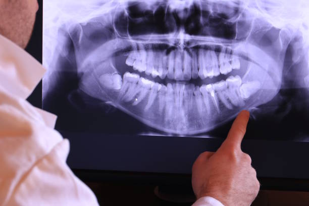 Best Pediatric Emergency Dentist in Port Ludlow, WA